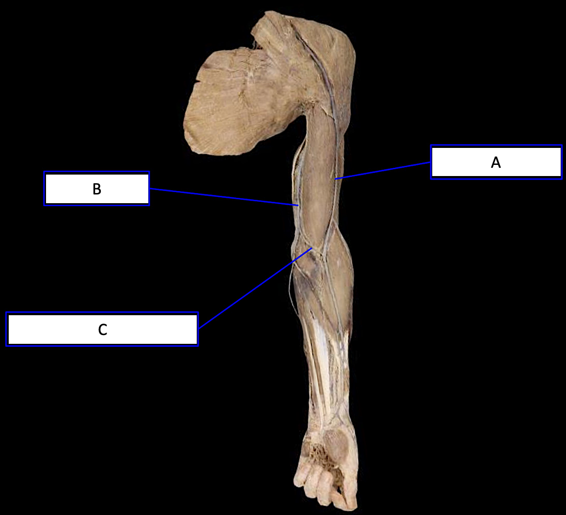 Upper Limbs Anatomy Quiz - Trivia & Questions